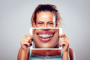 A woman holds a picture of a smile with braces in TX in front of her mouth