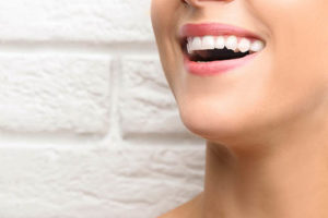 close up of woman's smile after dental bonding in bellaire tx