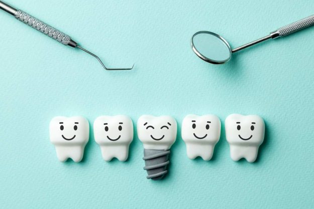 dental implants (2) Dental Implants